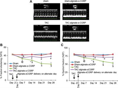 A Novel Alginate-Based Delivery System for the Prevention and Treatment of Pressure-Overload Induced Heart Failure